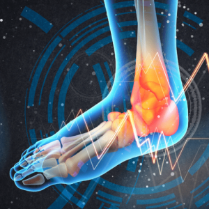 Reprogramación Deportiva PRO FicuVIR®